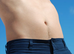 No Fat