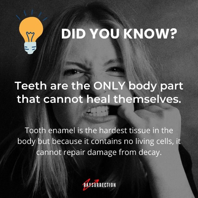 Interesting facts: Teeth are the only body part that cannot heal themselves.