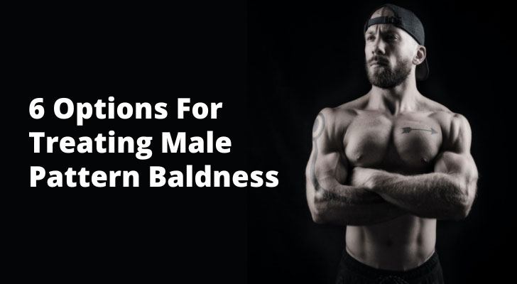 6 Options For Treating Male Pattern Baldness